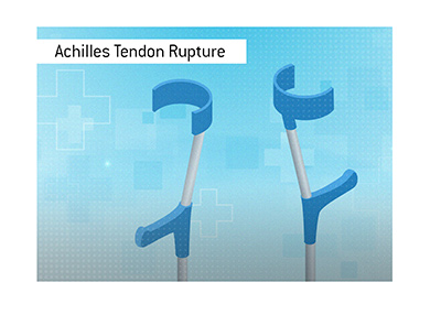 Achilles Tendon Rupture is one of the most serious injuries for a football player.