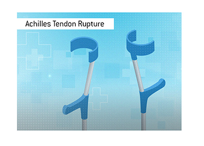 Achilles Tendon Rupture is one of the most serious injuries for a football player.