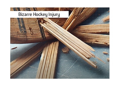 One of the most bizarre hockey injuries.